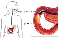 איור דרכי עיכול ואנדוסקופיה