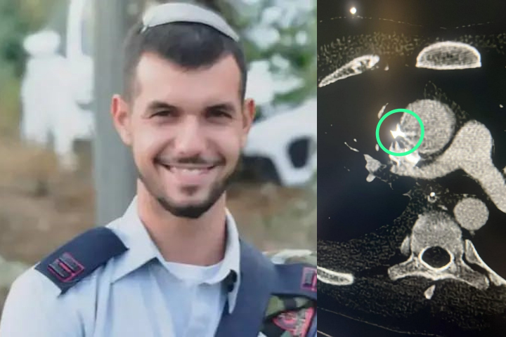 בתמונה: סרן במיל' מלאכי מונדני והרסיס שהתמקם בסמיכות לאבי העורקים. צילום: באדיבות המשפחה
